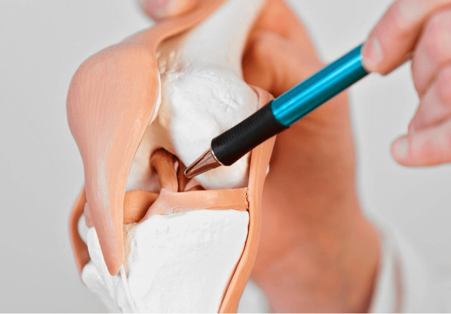 What Happens During a Ligament Sprain?