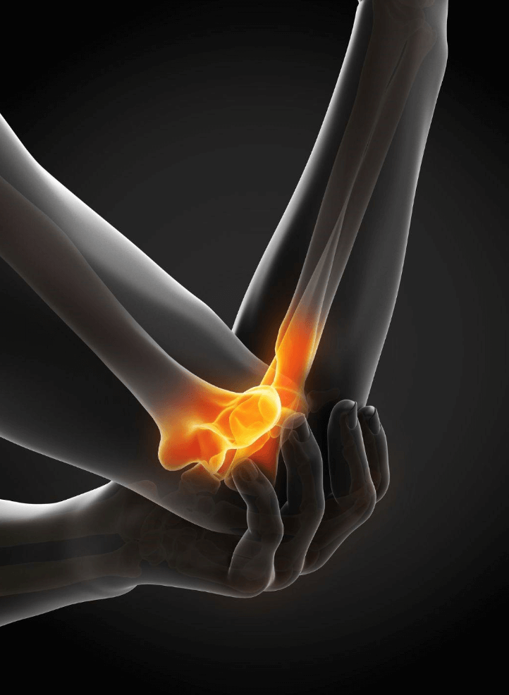 Tennis vs Golfer’s Elbow