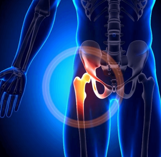 Rehab Exercises to RestoreSmooth Hip Motion